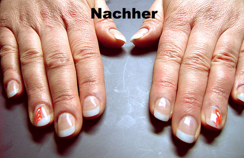 vom Nägelkauen zum Kunstnagel - Nachher-Bild