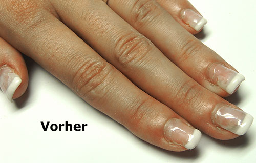 Nagelbeisser Nägel mit Gelmodellage von Privatperson