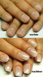Vorher-Nachher-Foto - brüchige Fingernägel vor der Nagelmodellage Acryl